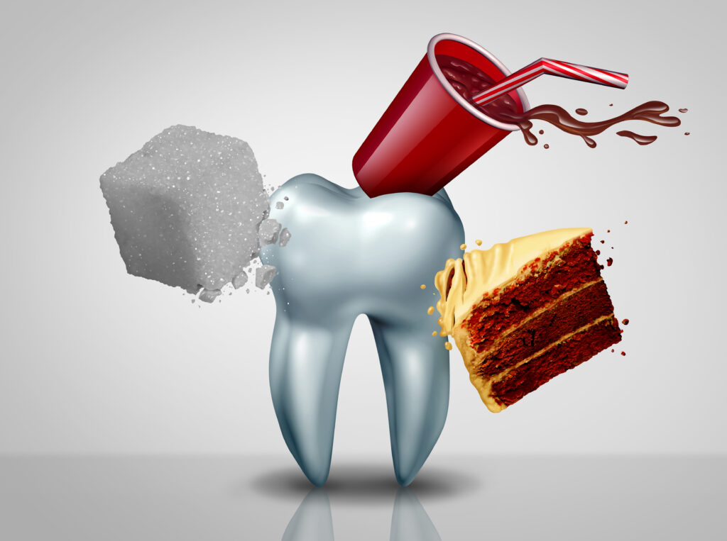 Preventing Cavities and Tooth Decay in Perth