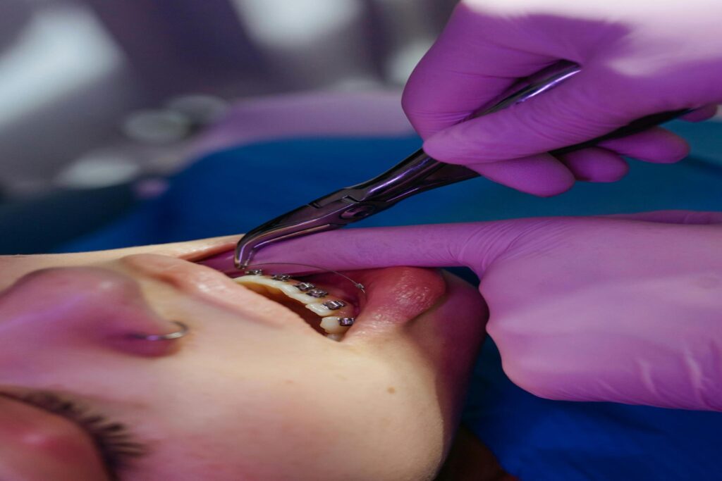 orthodontic treatment in perth