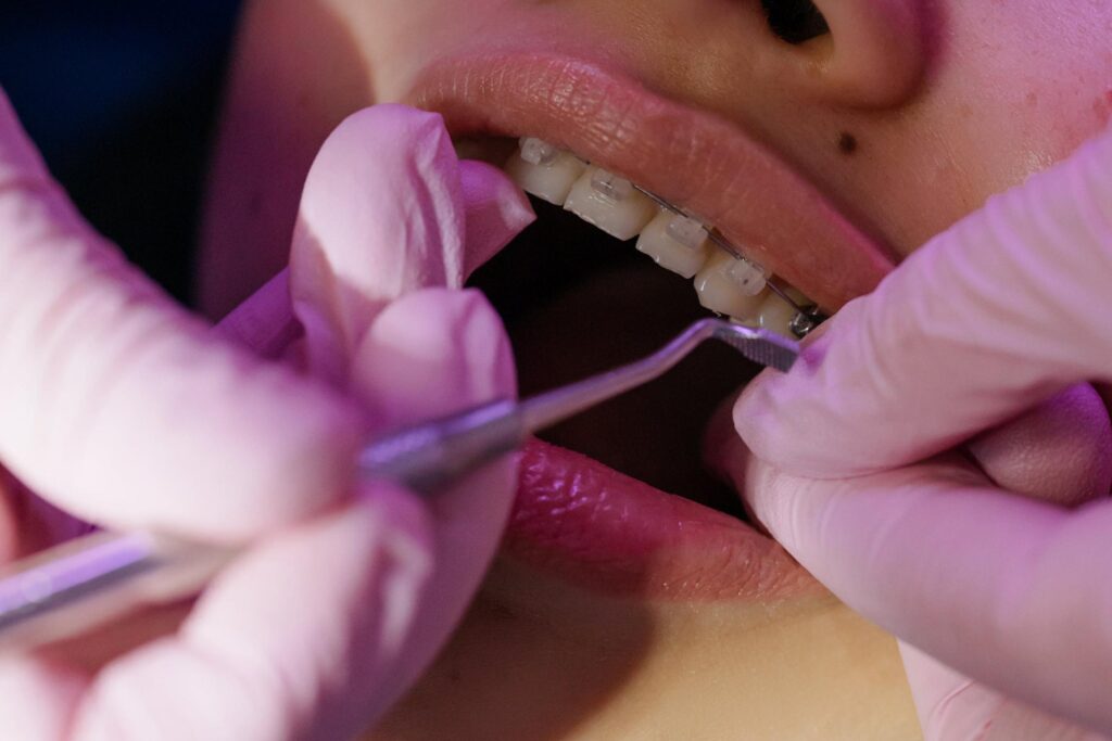 Orthodontic Treatment in Perth