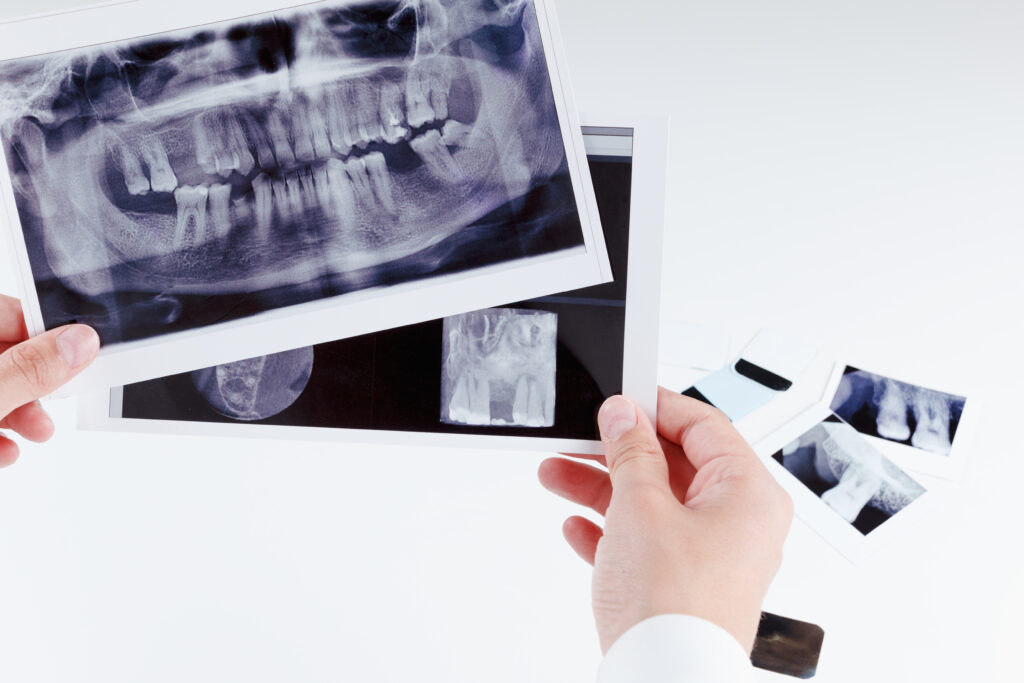 Advancements in Dental Radiology