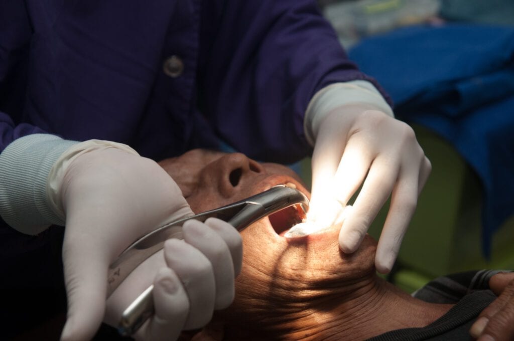 wisdom teeth removal Perth
