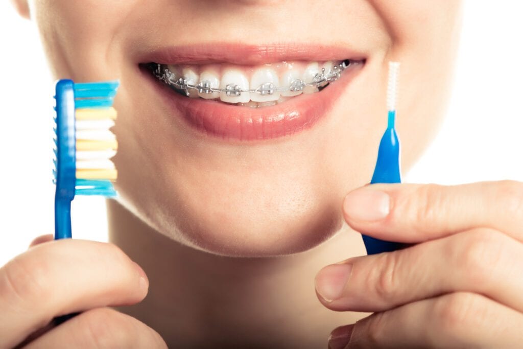 Dental Braces and Oral Hygiene